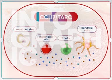 CCL17 (TARC): A Key Player and Biomarker in Atopic Dermatitis