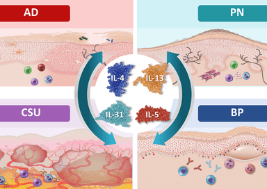 What Went Wrong? How Dysregulated Type 2 Immunity Contributes to AD, PN, CSU, and BP