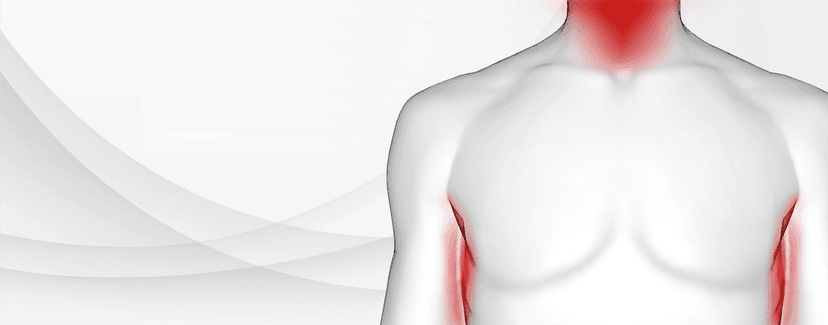 <b>Prurigo</b> <b>Nodularis</b> Learning Hub