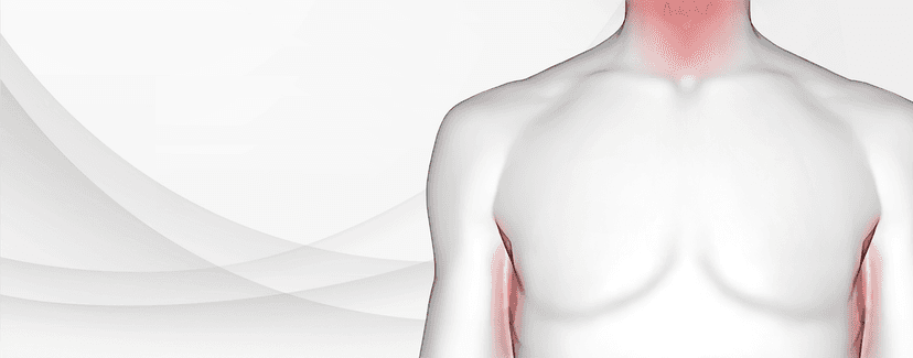 <b>Bullous</b> <b>Pemphigoid</b> Learning Hub