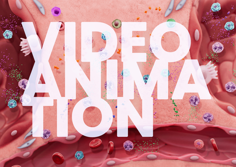 Pathways to Disease: Inflammation in Chronic Obstructive Pulmonary Disease Video