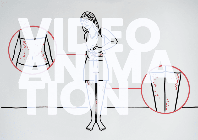 The <b>Burden</b> <b>of</b> Chronic Spontaneous Urticaria:  One Patient’s Journey to Diagnosis