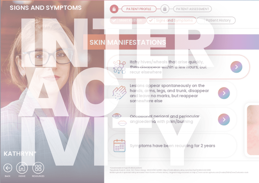 Guideline-Based Diagnosis <b>of</b> Chronic Spontaneous Urticaria: An Interactive Patient Case