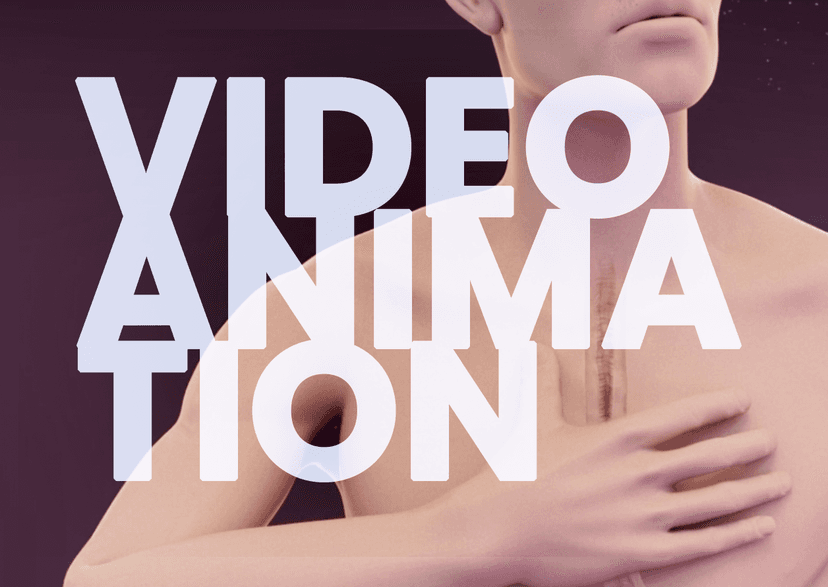 EoE Burden and <b>Pathophysiology</b> of Type 2 Inflammation