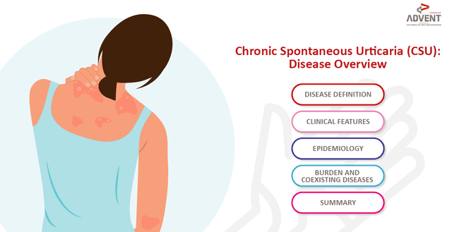 Chronic Spontaneous Urticaria (CSU): Disease Overview (Global)