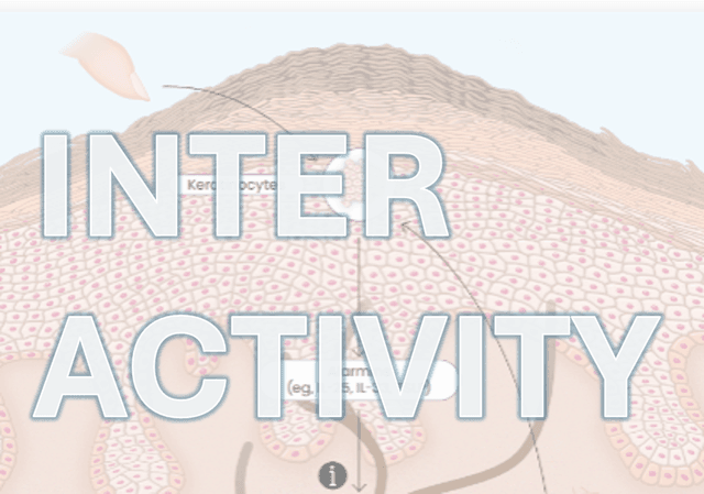 Prurigo Nodularis: Type 2 Inflammation Links Neuronal Dysfunction and Fibrosis 