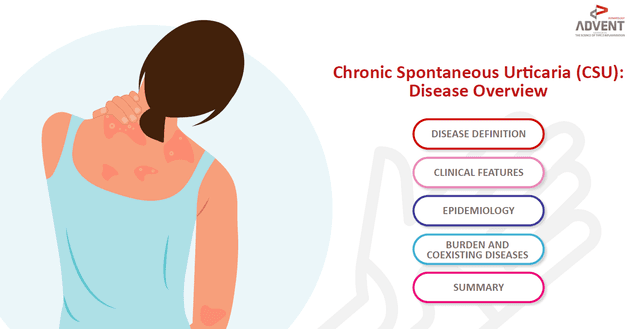 Chronic Spontaneous Urticaria (CSU): Disease Overview