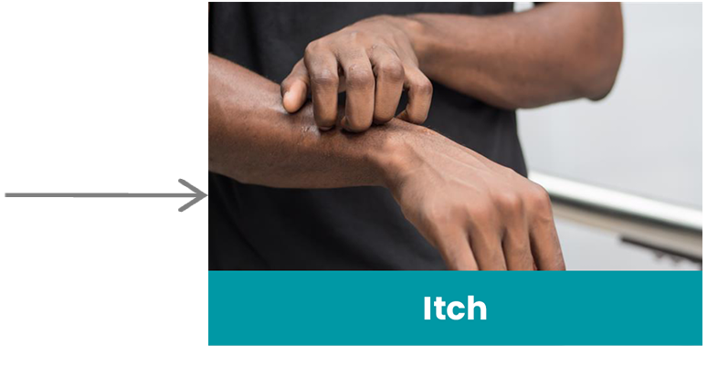 Itch