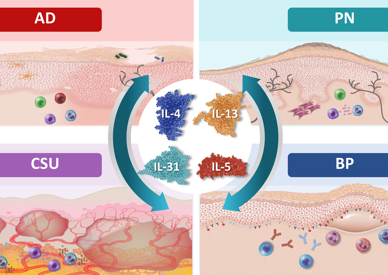 What Went Wrong? How Dysregulated Type 2 Immunity Contributes to AD, PN, CSU, and BP (Copy)