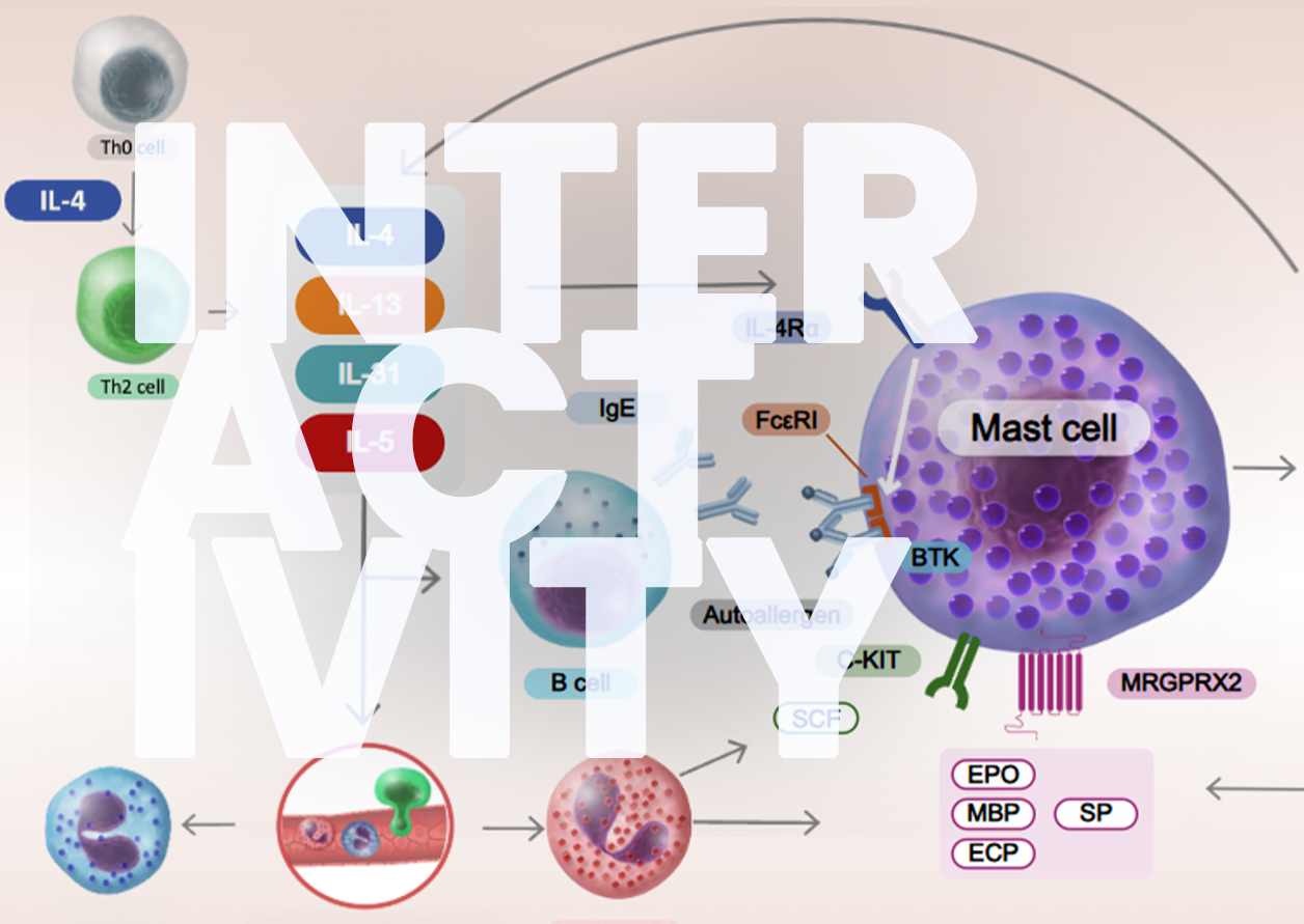 The Role of IL-4 and IL-13 in CSU Pathogenesis